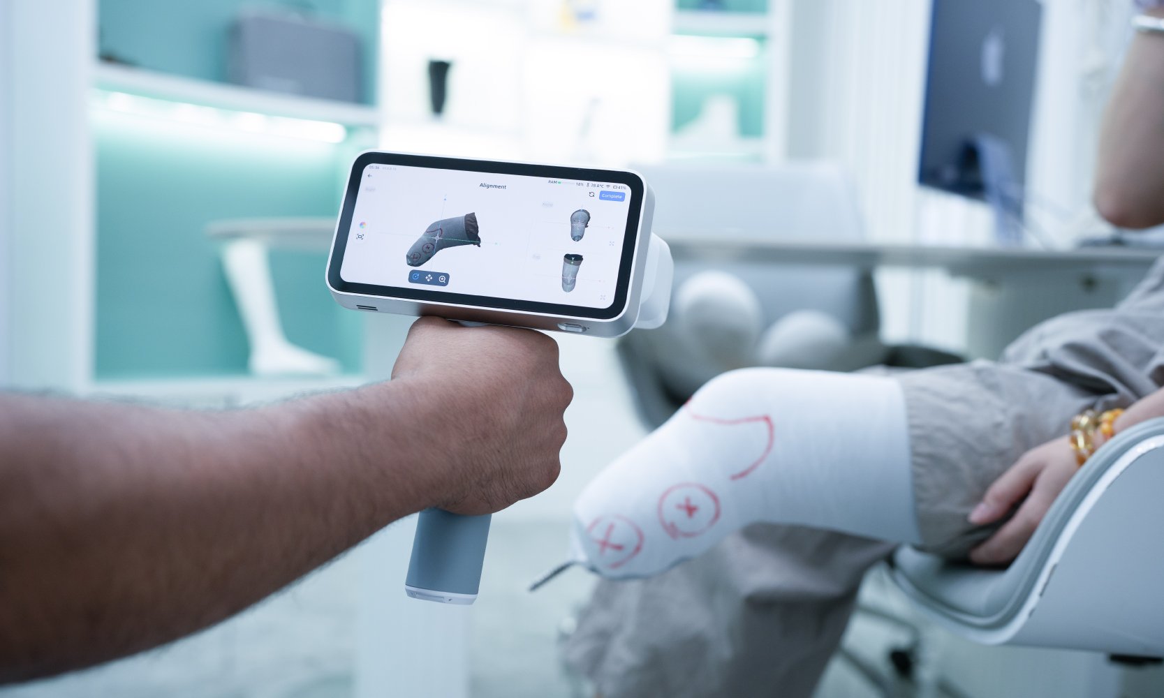 Prosthetic Socket
